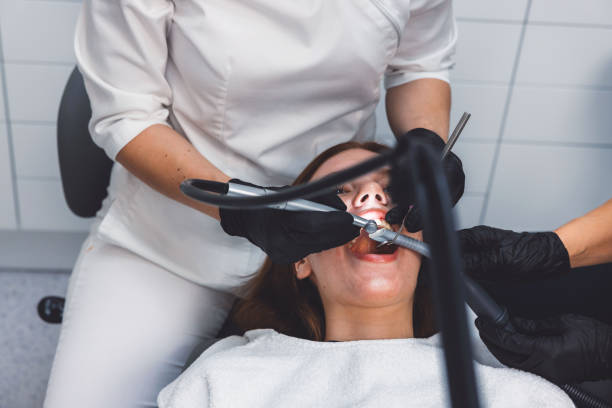 Best Emergency Tooth Extraction in Timnath, CO